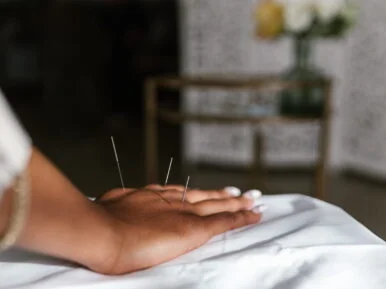 acupuncture_1625510617-scaled-434x290x24x0x386x290x1709387148