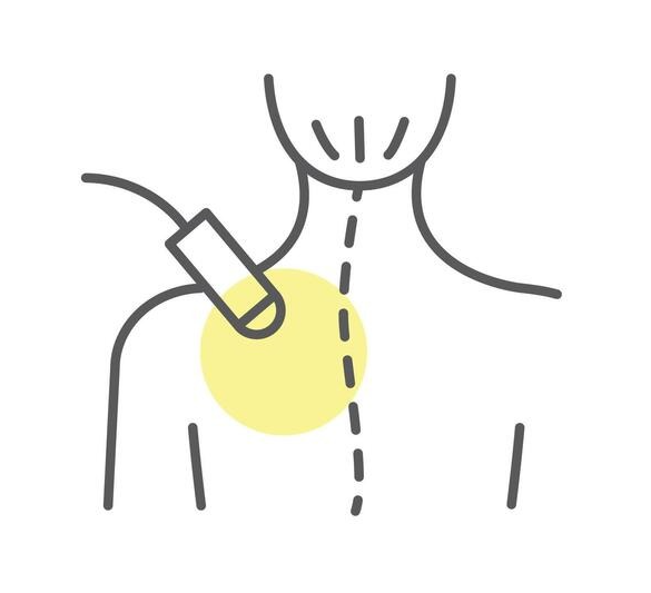 treatment with laser therapy line icon vector